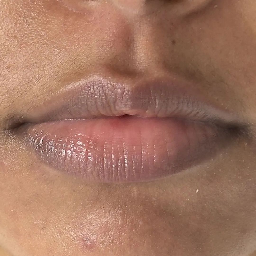 Close-up of a person's lips showing a glossy, muted mauve-pink lip color. This is the before shot, before applying the lip treatment