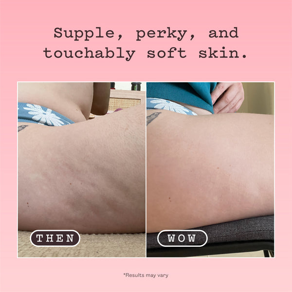 A pink promotional graphic with the text 'Supple, perky, and touchably soft skin.' above a side-by-side before/after style comparison labeled 'THEN' and 'WOW,' showing close-up views of skin texture on a person's hip/thigh area.