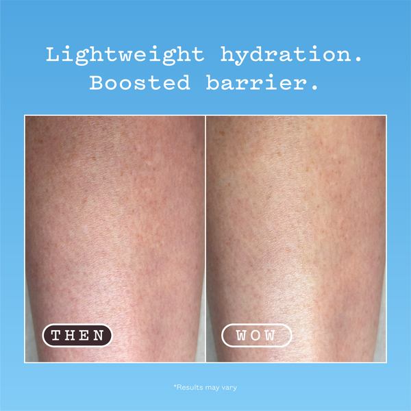 Lightweight hydration. Boosted barrier. Before and after using frank body Hyaluronic Acid Body Serum on the legs: dry, red, textured skin on the left, labelled THEN; smooth even skin on the right, labelled WOW. Results may vary.