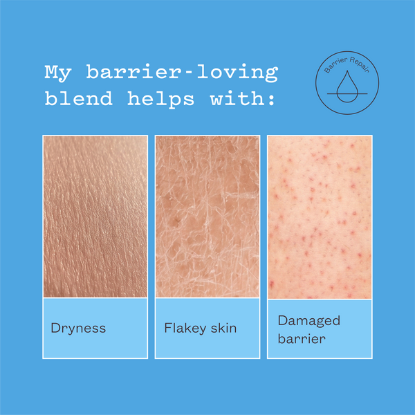 My barrier-loving blend helps with dryness, flaky skin and a damaged barrier.