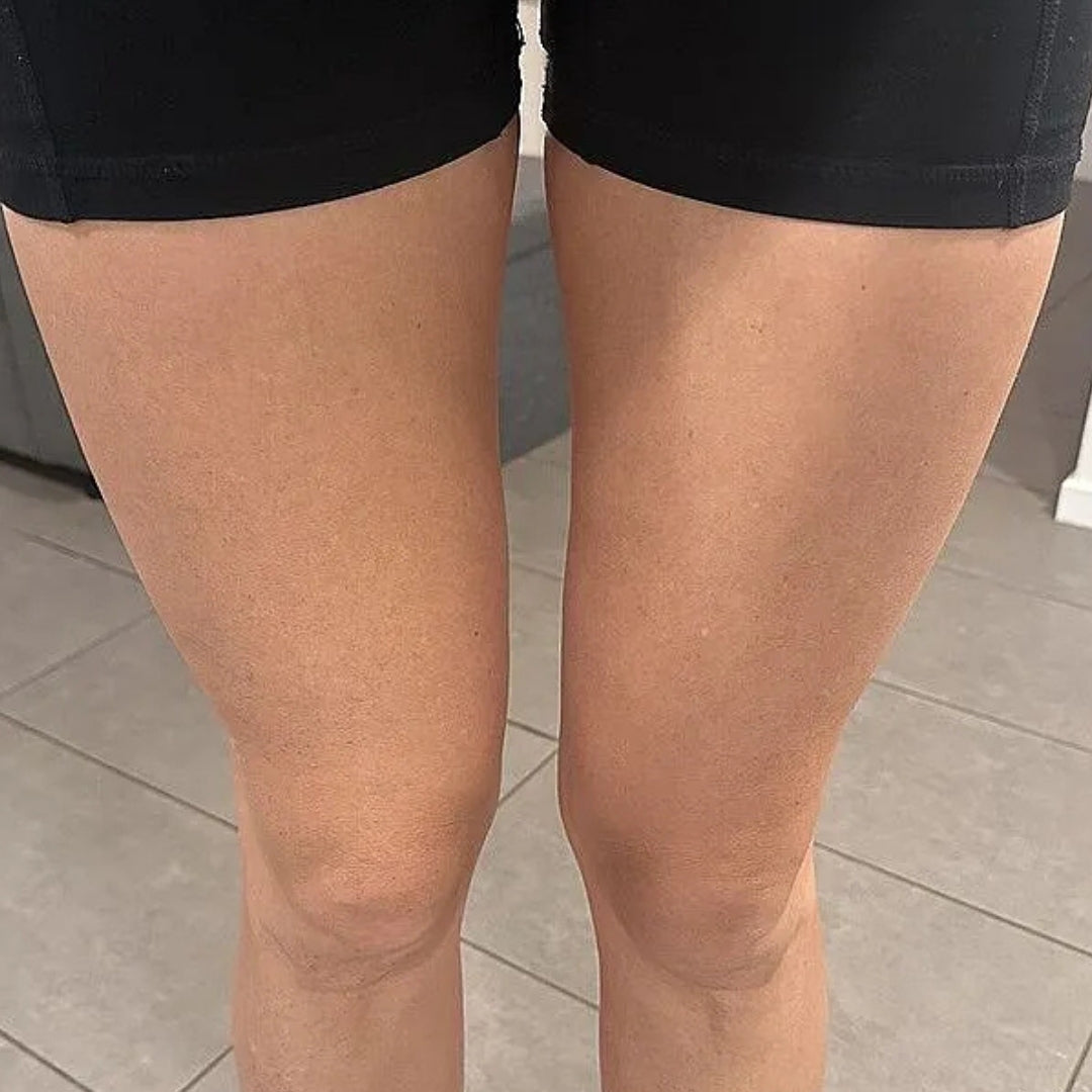 Close-up of a person's legs from the waist down, wearing black athletic shorts and standing on a light gray tiled floor. This the before picture.
