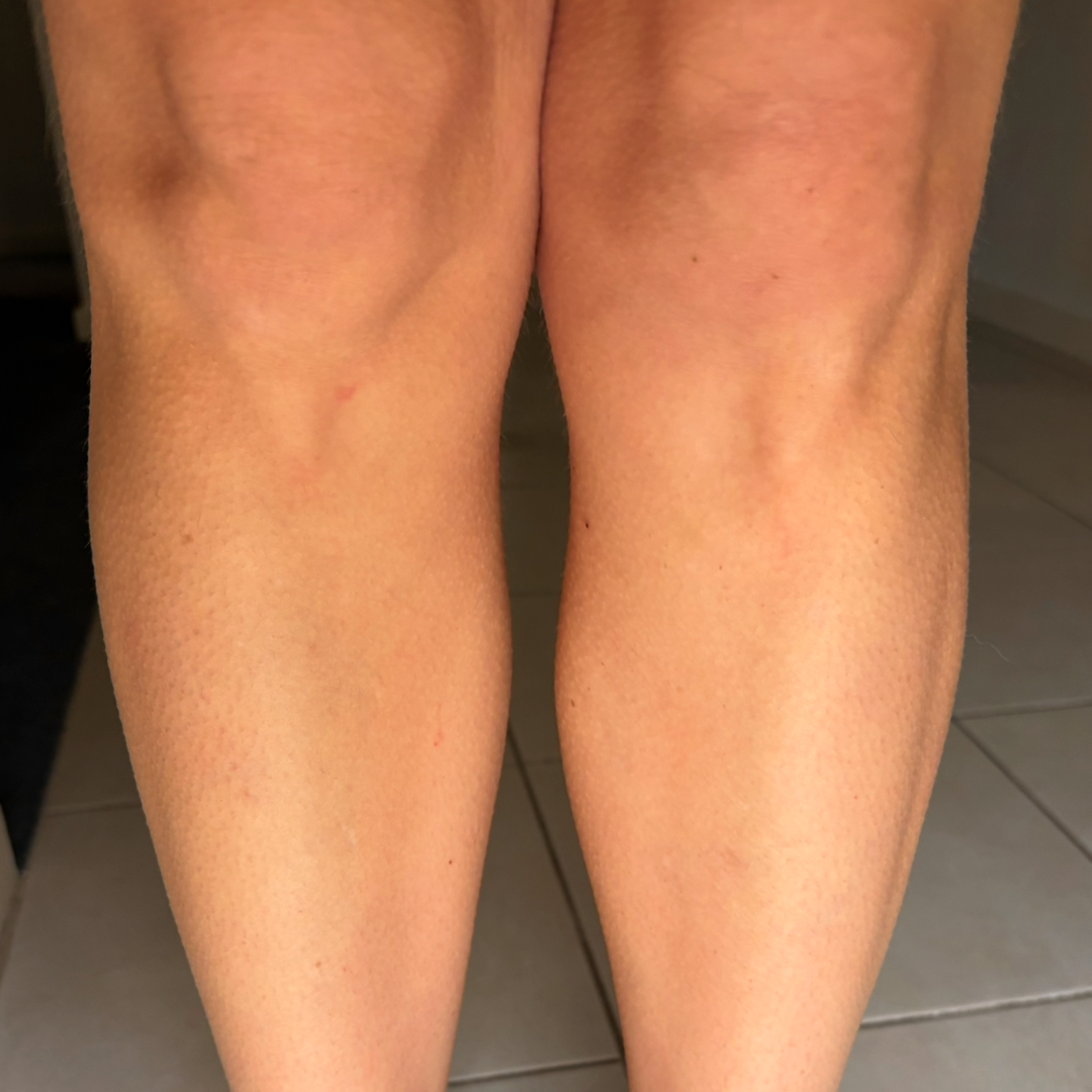 After using frank body Firm + Glow Tan Butter: bronzed, evenly tanned legs.