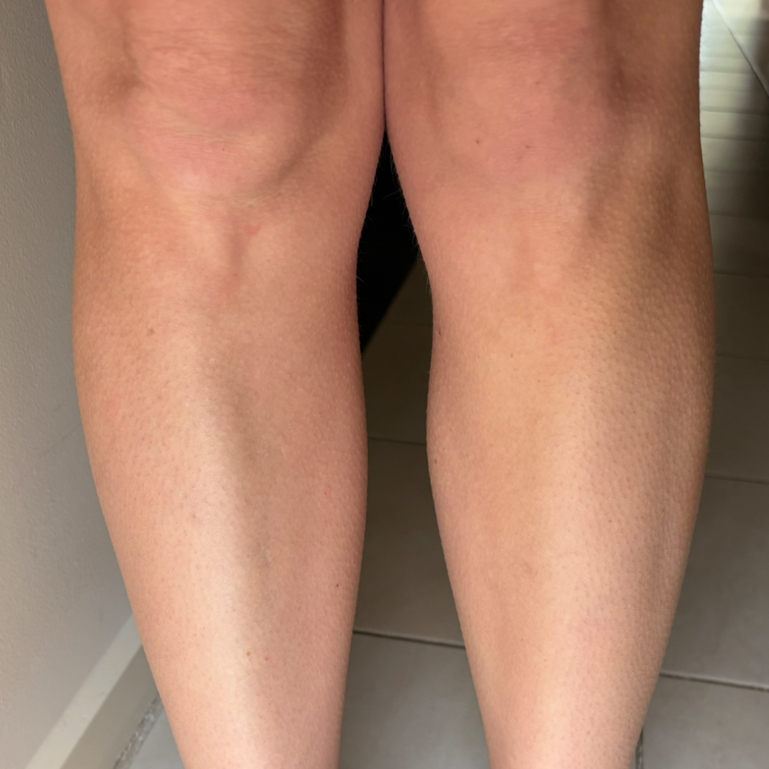 Before using frank body Firm + Glow Tan Butter: pale, untanned legs.