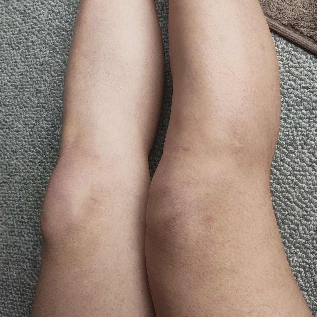 Before using frank body Firm + Glow Tan Butter: a pale, untanned forearm.