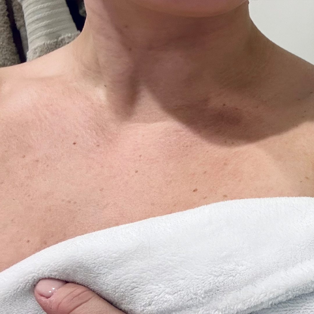Before using frank body Firm + Glow Self Tan Mousse: a pale, untanned stomach and torso.