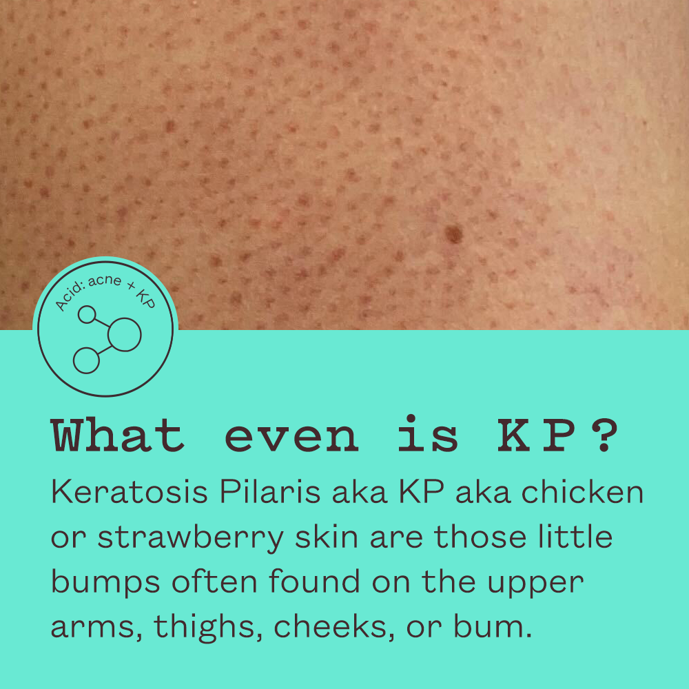 Triple Acid Body Wash