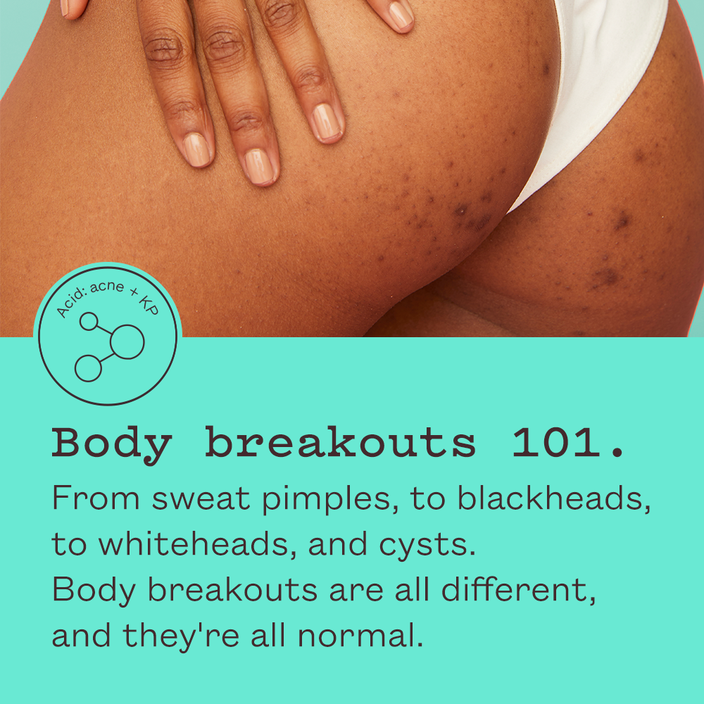 Triple Acid Body Mist